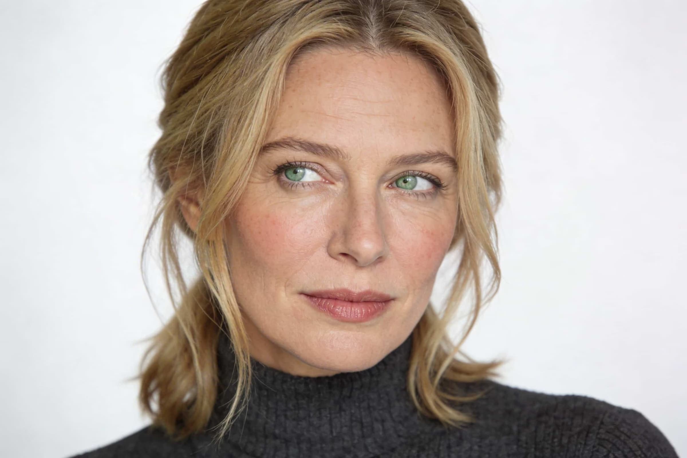 Middle third of the face and projection of the cheekbones.