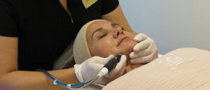 Read more about the article Hydrafacial care: deep skin hydration