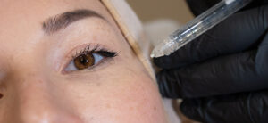 Read more about the article Beautification: trends in aesthetic medicine injections in 2023